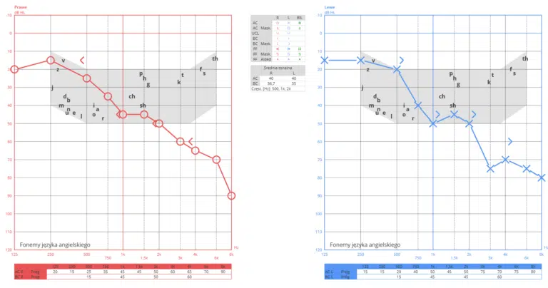 Wykresy audiogramu